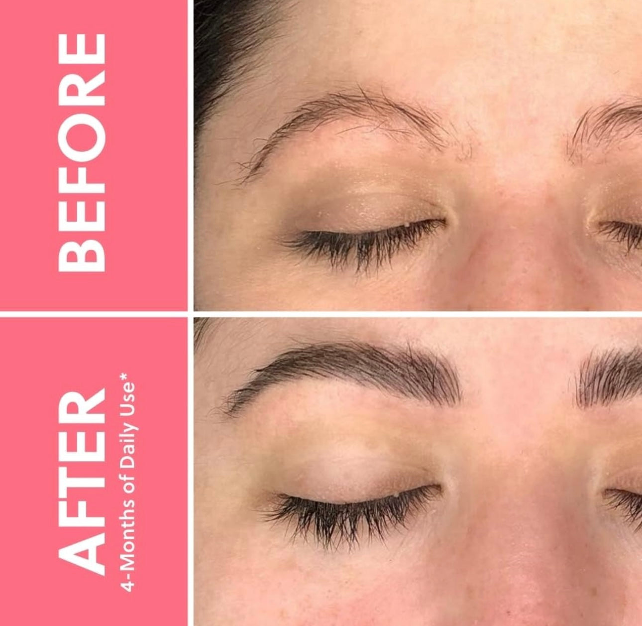 Forchics Forbrow Serum Para Crecimiento De Cejas Mas Gruesas
