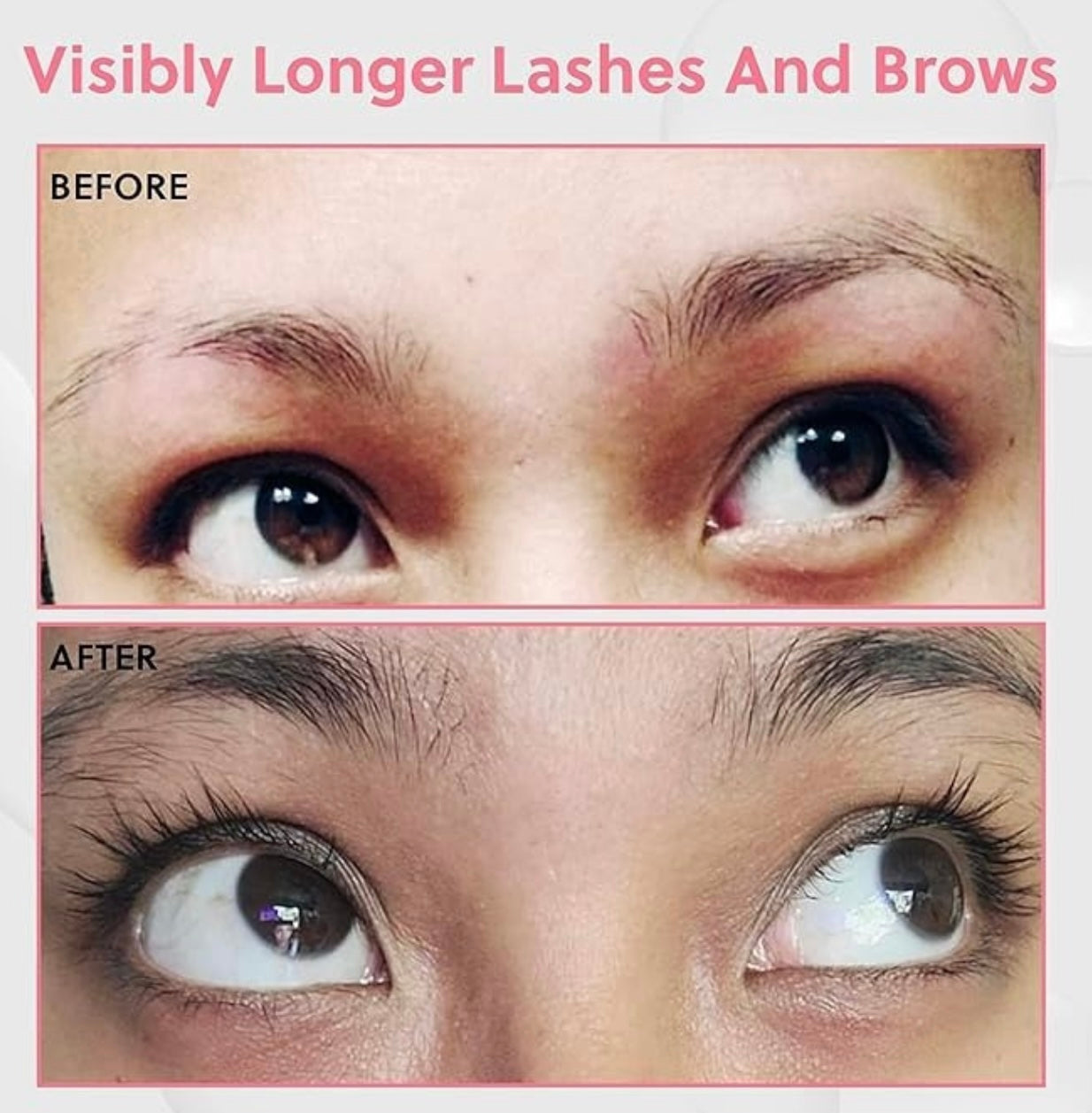Forchics Kit Serum - Crecimiento de pestañas y cejas